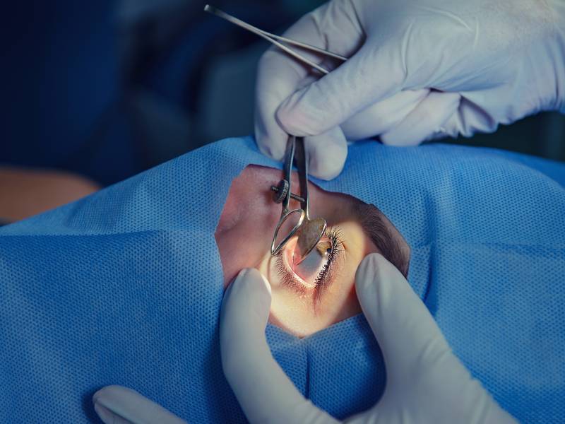 Blocked Tear Duct